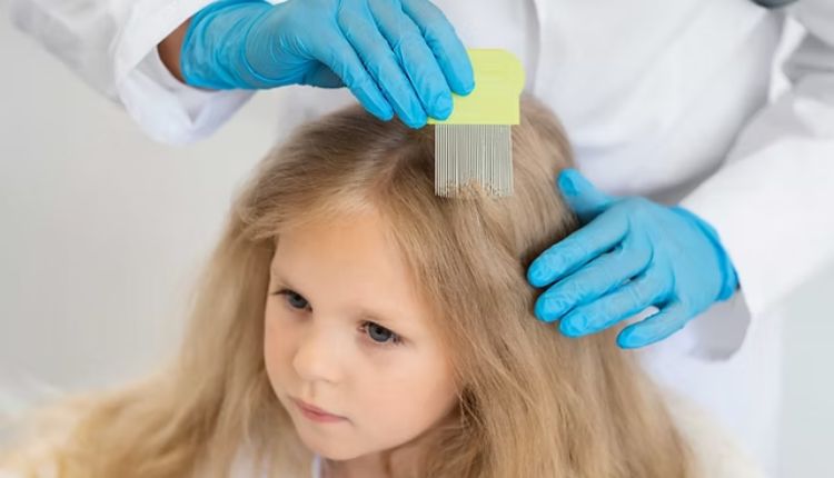 Professional Lice Removal In The Heart Of Brooklyn Brooklyn